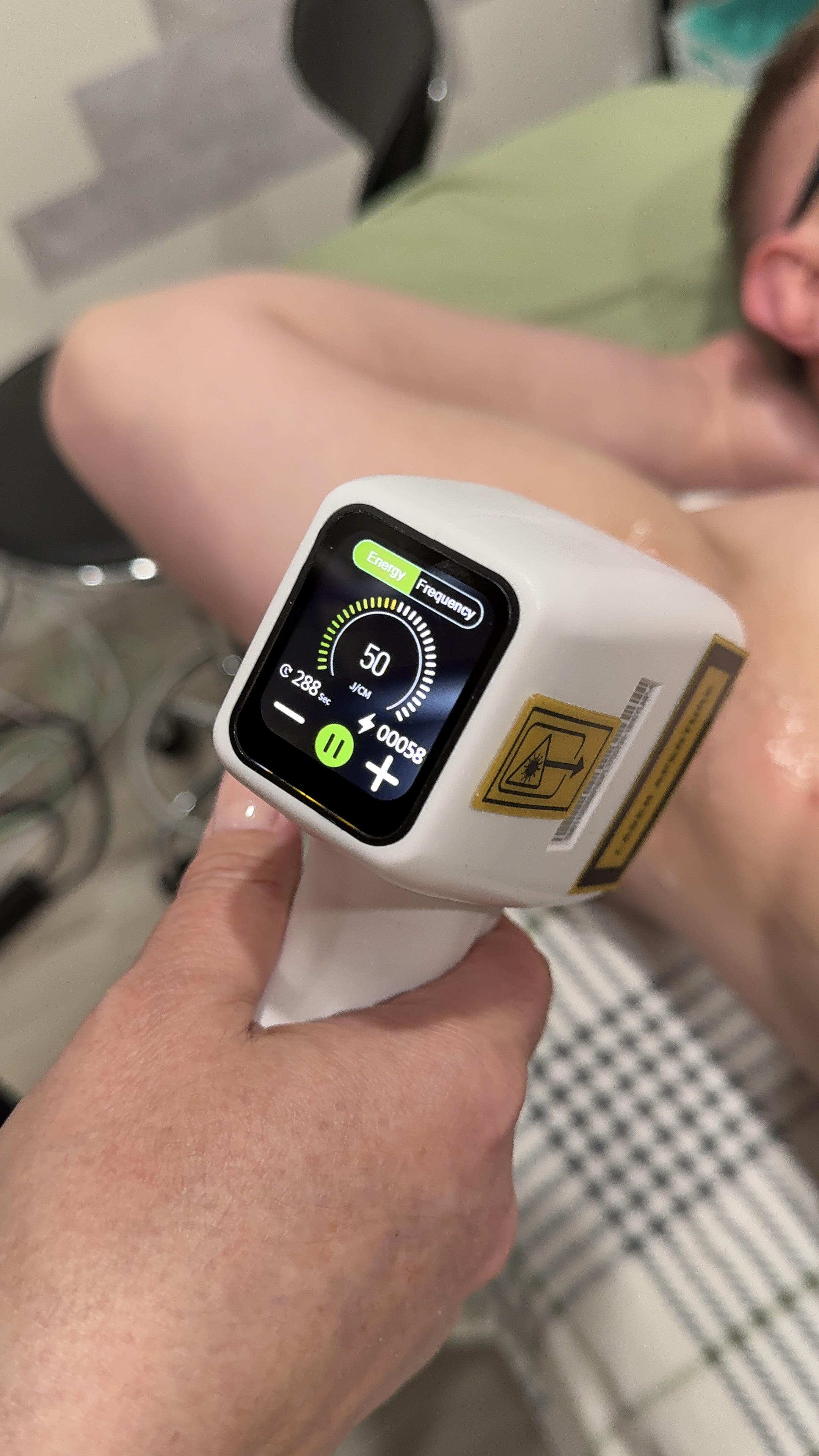 ⚡️Brazilian+Underarms Laser Hair Removal ⚡️