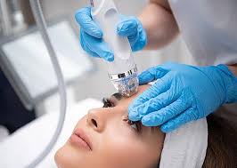 Microneedling - 3 sessions